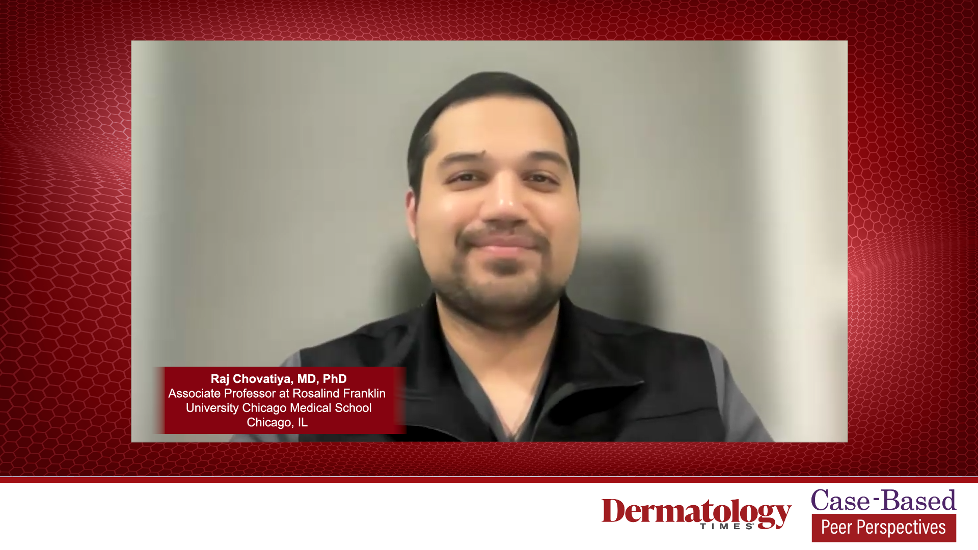 Dermatiidi Ravi Case-Based Approaches to Atopic Dermatitis Management | Dermatology Times