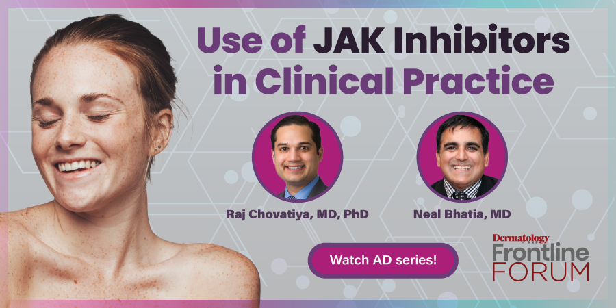 Use of JAK Inhibitors in Clinical Practice
