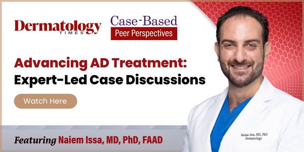 Advancing AD Treatment: Expert-Led Case Discussions