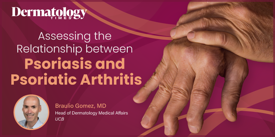 Assessing the Relationship Between Psoriasis and Psoriatic Arthritis 