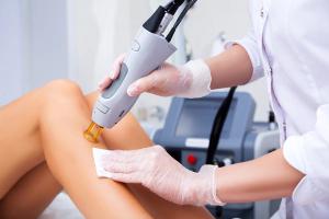 Laser hair removal