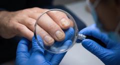 Psoriasis FAQs: What NPs and PAs Should Know