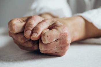 Two-Year POETYK PsA-2 Data Show Durable Deucravacitinib Responses in Psoriatic Arthritis