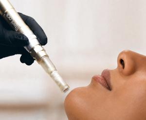 ICYMI: SkinStylus Gains FDA Clearance for Periorbital Wrinkles Across All Fitzpatrick Skin Types