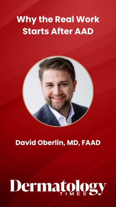 Why the Real Work Starts After AAD