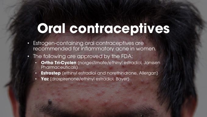 Oral contraceptives for acne