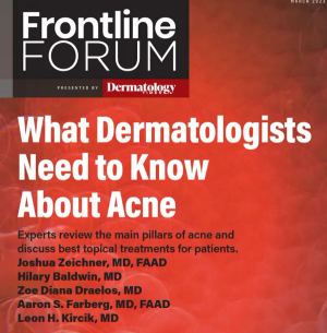 Frontline Forum Part 2: A Discussion of the Pathophysiology of Acne and Available Treatment Strategies