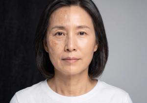 Skin Longevity Needs Evidence, Not Hype