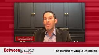 The Burden of Atopic Dermatitis