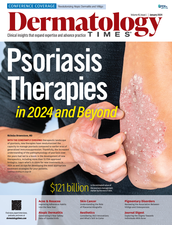 latest research in psoriasis