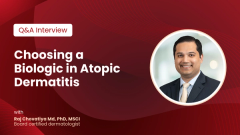 EP. 4 Choosing a Biologic in Atopic Dermatitis