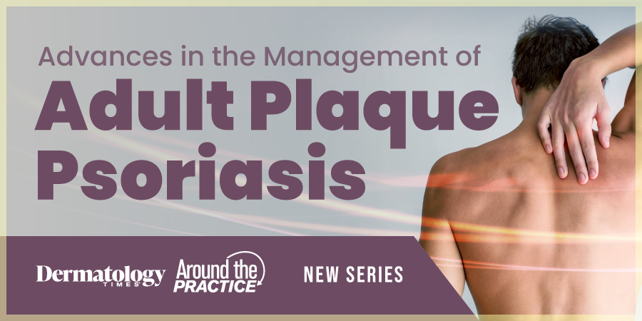Advances in the Management of Adult Plaque Psoriasis