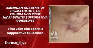 AAD, HS Foundation Issue First Joint Hidradenitis Suppurativa Guidelines | Credit: DermNet.nz