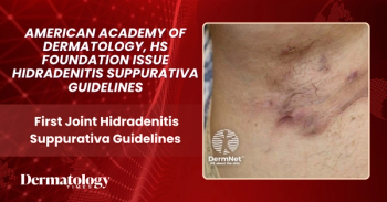AAD, HS Foundation Issue First Joint Hidradenitis Suppurativa Guidelines | Credit: DermNet.nz