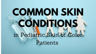 Common skin conditions in pediatric skin of color patients