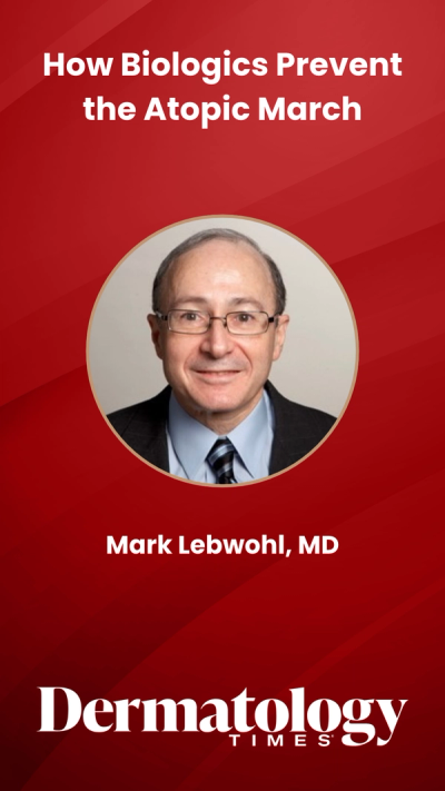How Biologics Prevent the Atopic March