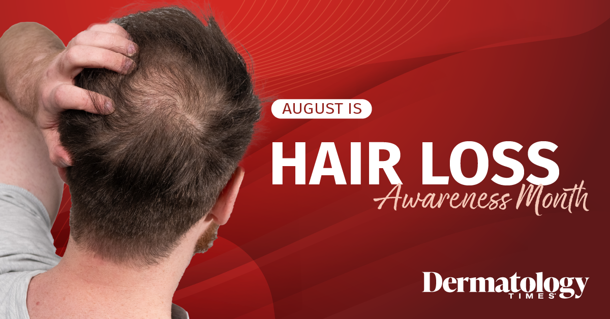 Celebrating Hair Loss Awareness Month 2025 with Dermatology Times