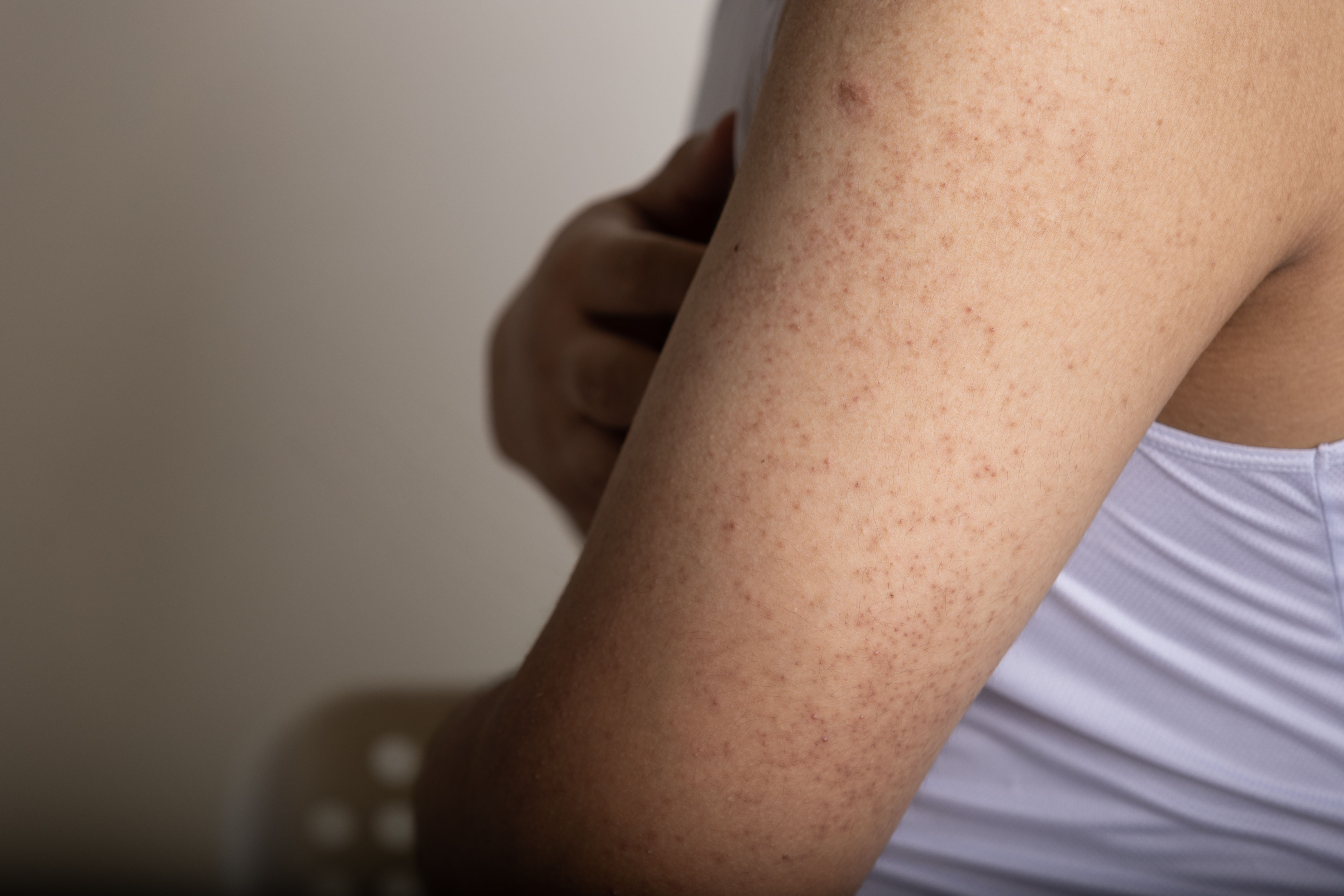 how long for glutathione iv to work Will IV glutathione work for everyone? , With almost 10 years of  experience, my answer is no. The results of IV glutathione vary depending  on , 1) what outcome we are using it for ( doesn’t work for