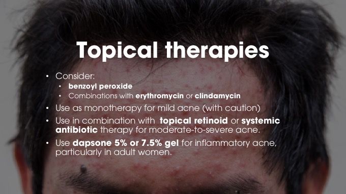 CASPAR criteria psoriatic arthritis