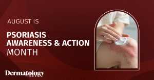 National Psoriasis Awareness Month 2026: More Oral Options, Wider Access, and a Systemic Lens