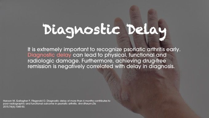 psoriatic arthritis diagnosis