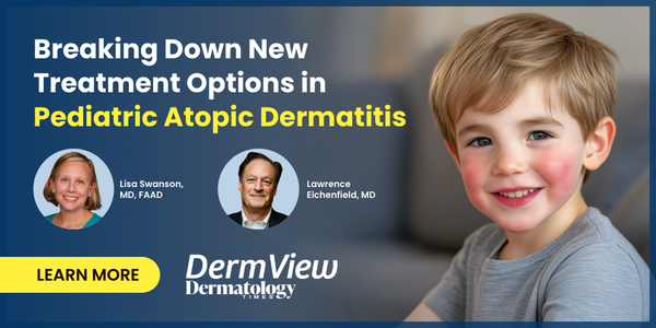 Breaking Down New Treatment Options in Pediatric Atopic Dermatitis