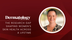 The Research Gap Shaping Women's Skin Health Across a Lifetime