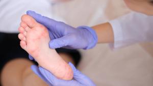 FDA Grants QRX003 Rare Pediatric Disease Designation in Peeling Skin Syndrome
