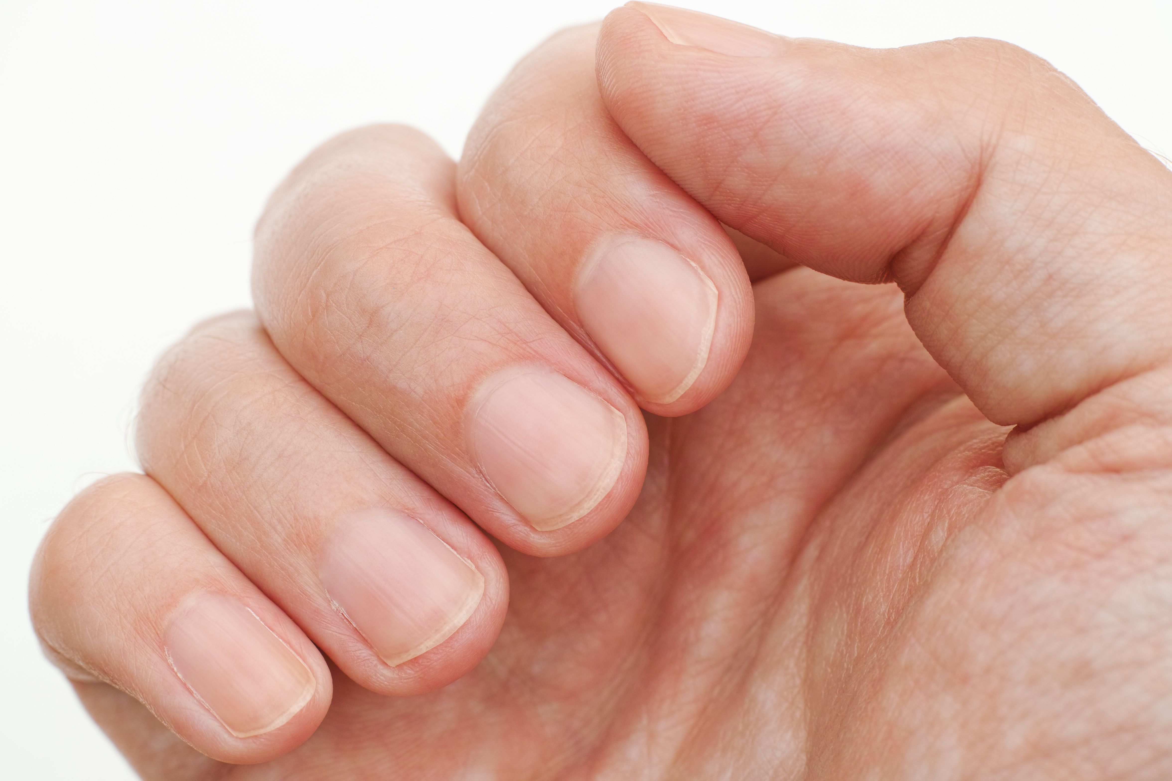 Вирус ногти на пальцах
