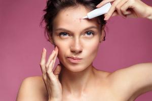 Consider Mental Health Concerns in Teens With Acne