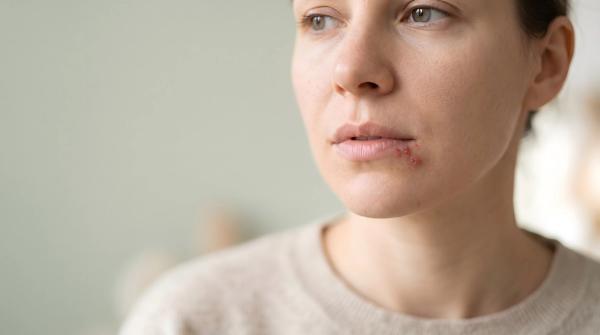 FDA Approves Pritelivir for Refractory Mucocutaneous HSV in Immunocompromised Adults