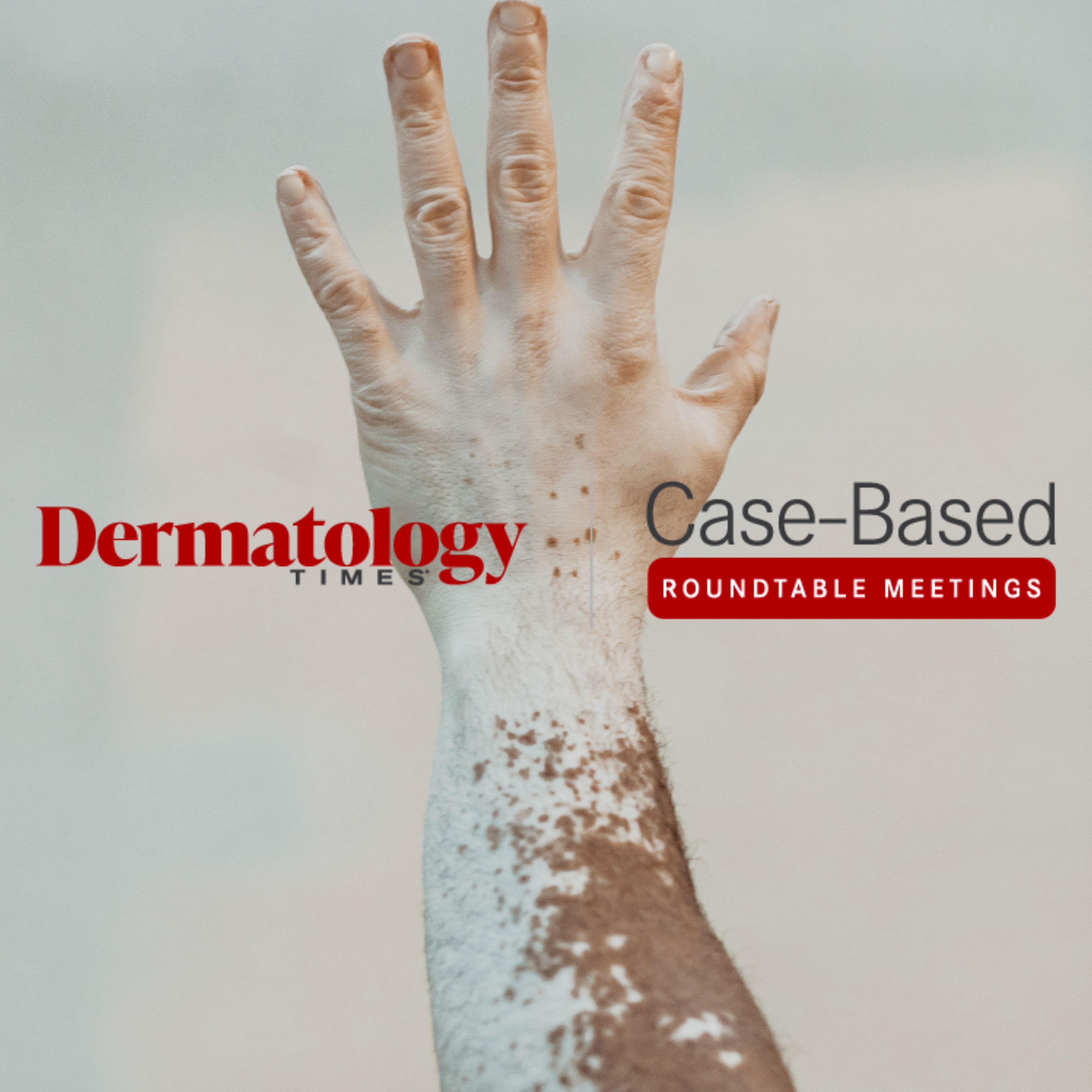 Dermatology Times on X: The November issue of Dermatology Times is live!  Learn more about age considerations for #AtopicDermatitis care, new data  related to #acne in adult women, and more. Download now