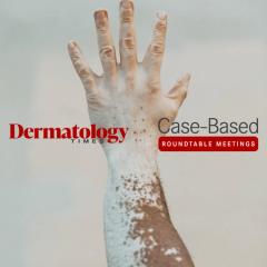 EP. 4 Case Based Roundtables Part 1: Valorizing Topical Treatment Options for Patients With Vitiligo