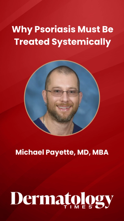 Why Psoriasis Must Be Treated Systemically