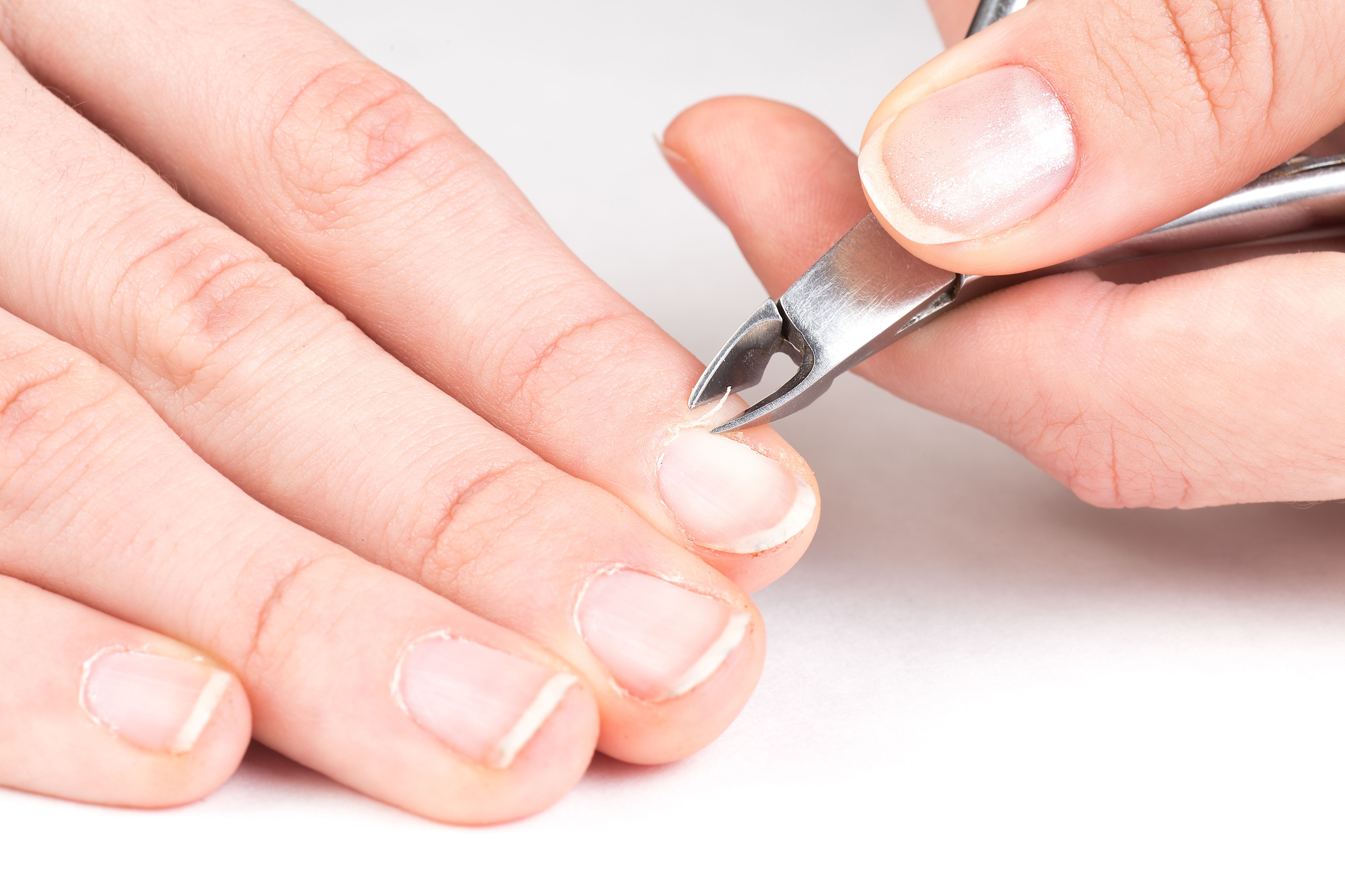 Nail Trends That Challenge Clinical Diagnosis