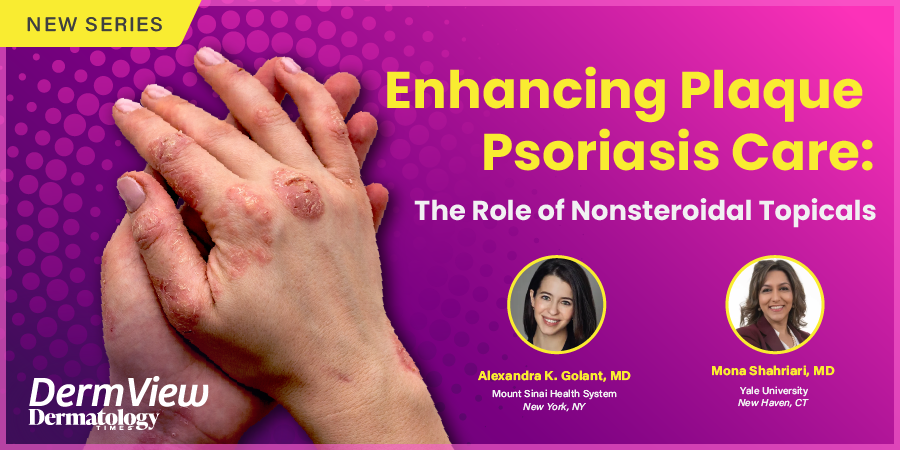 Enhancing Plaque Psoriasis Care: The Role of Nonsteroidal Topicals