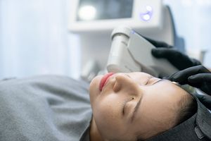 high intensity focused ultrasound on female face