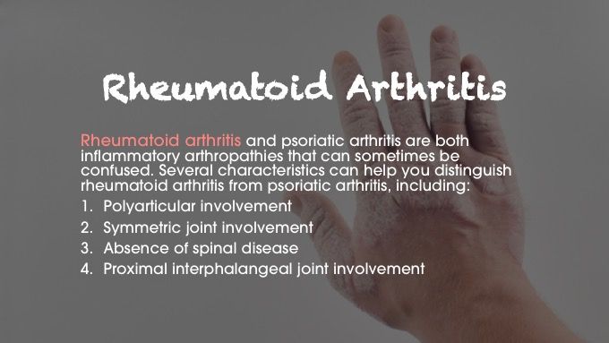 rheumatoid arthritis psoriatic arthritis differential diagnosis