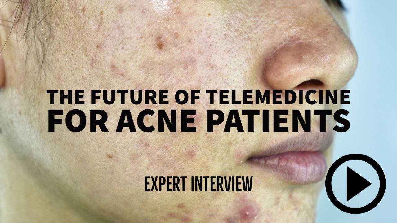 Will telemedicine impact the future of acne care?