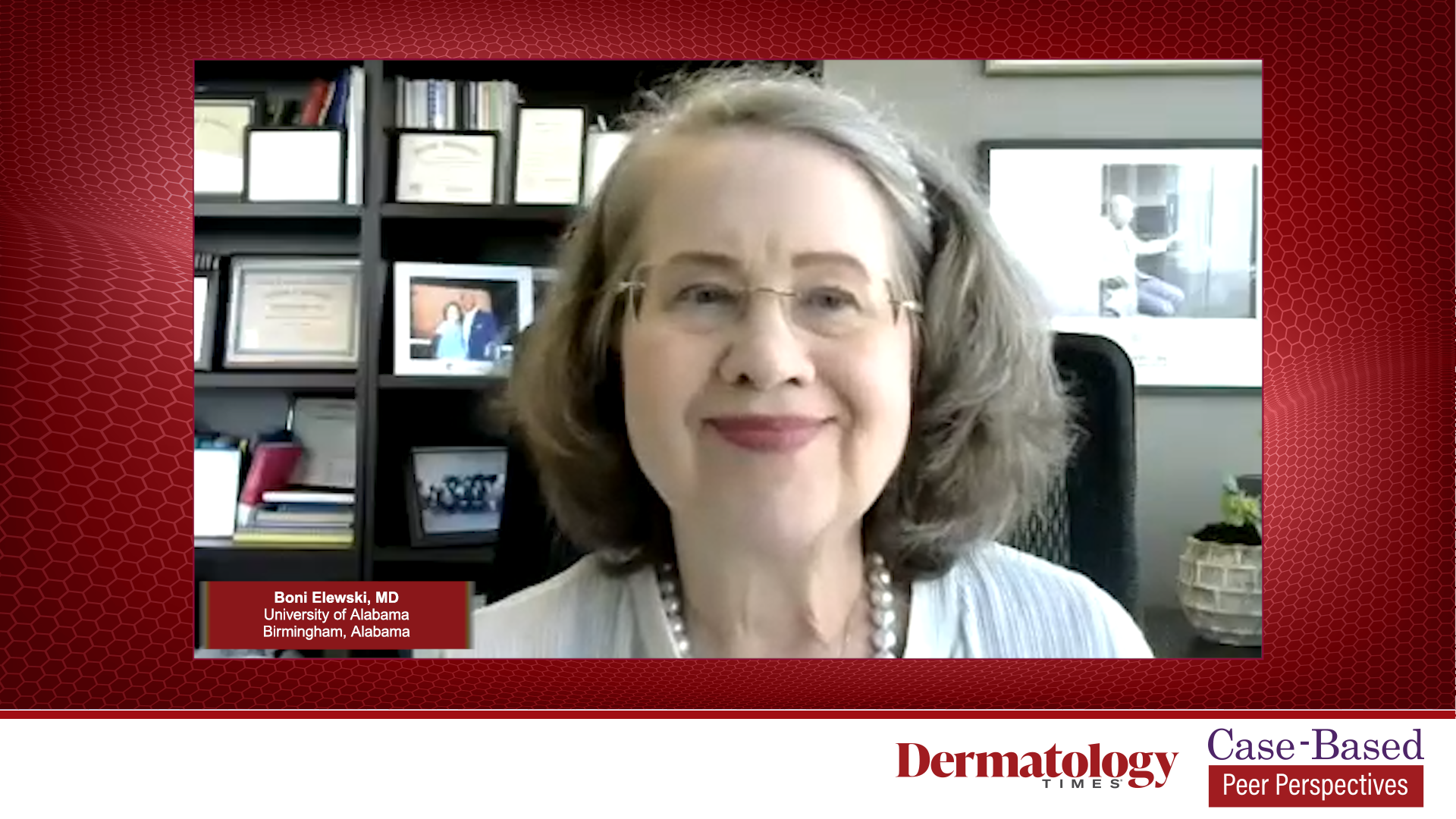 Treatment Selection in GPP Treatment Selection in GPP