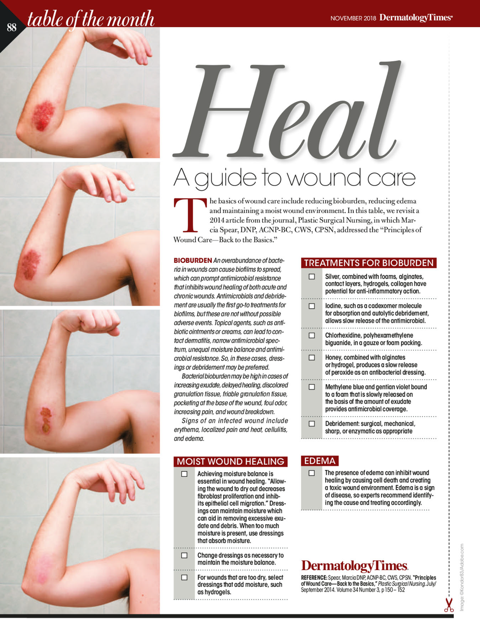 Heal: A guide to wound care