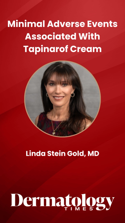 Minimal Adverse Events Associated With Tapinarof Cream