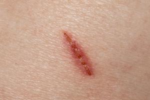 Frequency-Specific Sound Enhances Tissue Regrowth