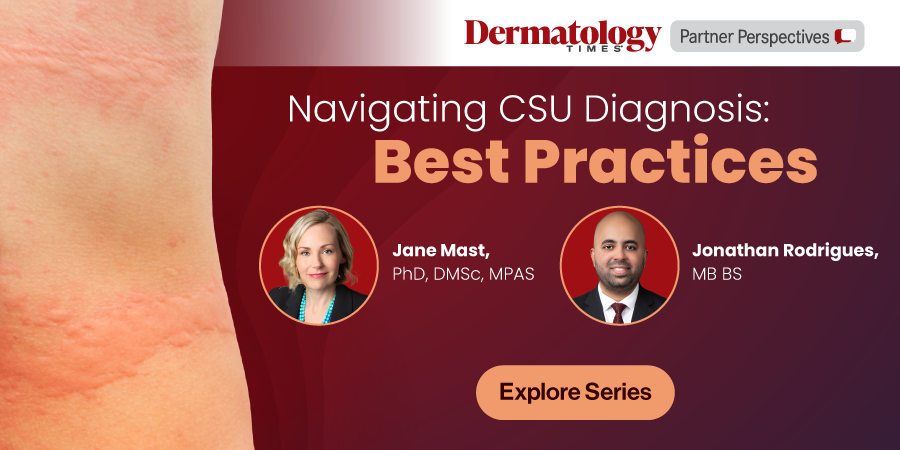 Navigating CSU Diagnosis: Best Practices