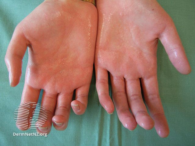 Условия способствующие заражению псевдотуберкулезом ответ гигтест: найдено 88 из