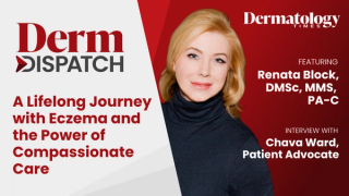 Derm Dispatch: A Lifelong Journey with Eczema and the Power of Compassionate Care