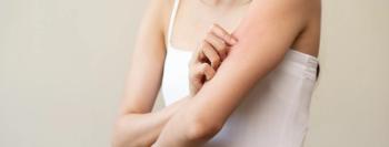 Pormezz/Adobestock redness atopic dermatitis puzzling case