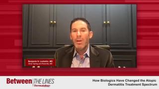 How Biologics Have Changed the Atopic Dermatitis Treatment Spectrum