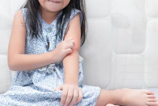 The Burden of Itch for Pediatric Patients and Parents