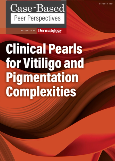 Dermatology Times, Clinical Pearls for Vitiligo and Pigmentation Complexities, October 2024 (Vol. 45. Supp. 07)